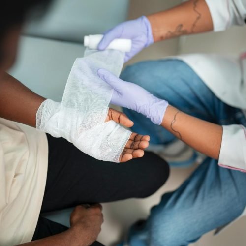 Queimaduras durante o São João: saiba como prevenir e tratar lesões típicas do período junino