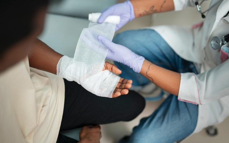 Queimaduras durante o São João: saiba como prevenir e tratar lesões típicas do período junino